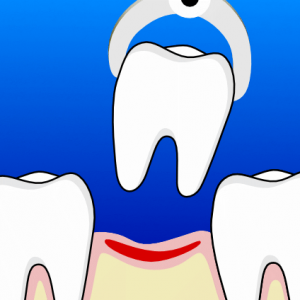 Cirugía Oral